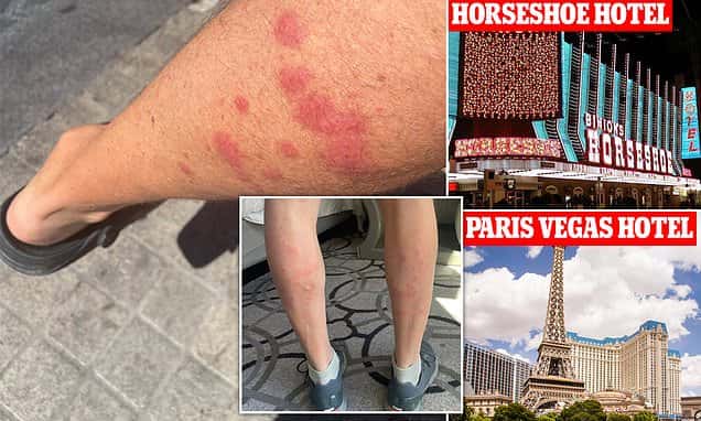 Las Vegas hotels overrun with BED BUGS including MGM Grand, Palazzo and Caesars Palace where rooms go for up to $40K-a-night: World Series of Poker players post grim pics of huge red bites | Daily Mail Online